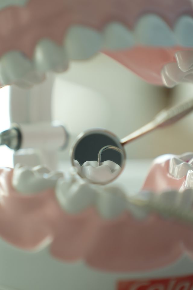 Czy implant zęba boli podczas wszczepienia?